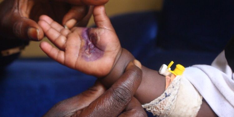 Ntinda Clinic Admits Possible Error as Mother Battles for Answers Over Baby’s Injuries