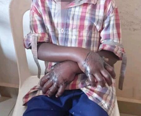 Wakiso Child Torture Case Sparks Outrage as Police Arrest Boy’s Father, Uncle, and Aunt