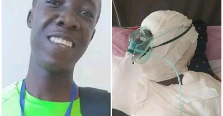Burnt To Death, Kyambogo Freshman Dies After Suspected Cooking Coil Explosion at Rental Home